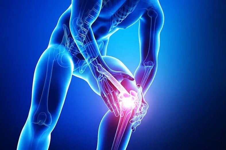 arthrosis symptoms